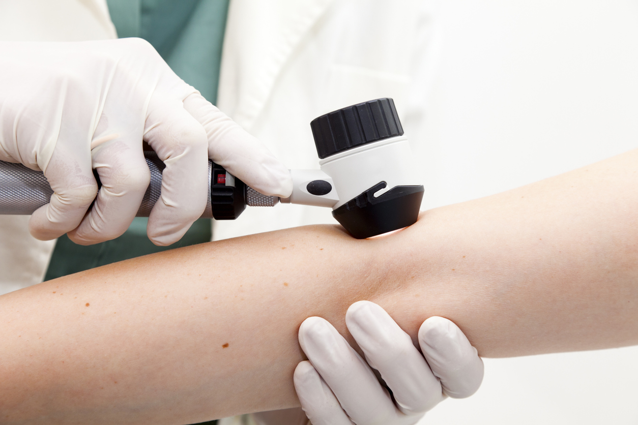 Free Skin Cancer Screenings Available May 7 Spectrum Health Newsroom